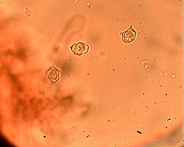 Messa a punto del microscopio